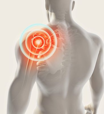 Shoulder and Rotator Cuff Injuries Treatment